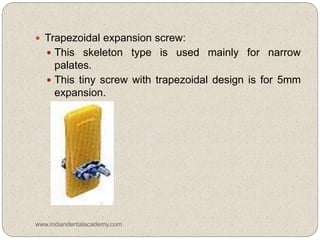  Trapezoidal expansion screw:
 This skeleton type is used mainly for narrow
palates.
 This tiny screw with trapezoidal design is for 5mm
expansion.
www.indiandentalacademy.com
 