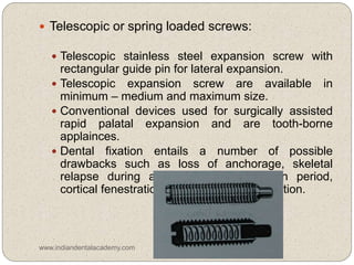  Telescopic or spring loaded screws:
 Telescopic stainless steel expansion screw with
rectangular guide pin for lateral expansion.
 Telescopic expansion screw are available in
minimum – medium and maximum size.
 Conventional devices used for surgically assisted
rapid palatal expansion and are tooth-borne
applainces.
 Dental fixation entails a number of possible
drawbacks such as loss of anchorage, skeletal
relapse during and after the expansion period,
cortical fenestration and buccal root resorption.
www.indiandentalacademy.com
 