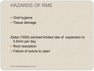 HAZARDS OF RME
 Oral hygiene
 Tissue damage
Ziebe (1930) advised limited rate of expansion to
0.5mm per day
 Root resorption
 Failure of suture to open
www.indiandentalacademy.com
 