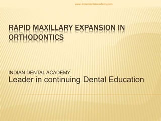 RAPID MAXILLARY EXPANSION IN
ORTHODONTICS
INDIAN DENTAL ACADEMY
Leader in continuing Dental Education
www.indiandentalacademy.com
 