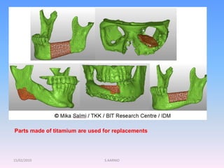 15/02/2010 S.AARNIO
Parts made of titamium are used for replacements
 