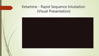 Ketamine - Rapid Sequence Intubation
(Visual Presentation)
 