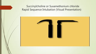 Succinylcholine or Suxamethonium chloride
Rapid Sequence Intubation (Visual Presentation)
 