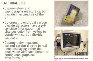 Rapid sequence intubation in ED