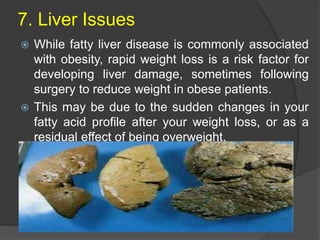 7. Liver Issues
 While fatty liver disease is commonly associated
with obesity, rapid weight loss is a risk factor for
developing liver damage, sometimes following
surgery to reduce weight in obese patients.
 This may be due to the sudden changes in your
fatty acid profile after your weight loss, or as a
residual effect of being overweight.
 