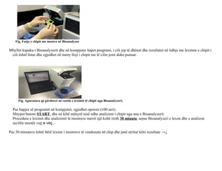 Fig. Futja e chipit me mostra në Bioanalyzer
Mbyllet kapaku i Bioanalyzerit dhe në kompjuter hapet programi, i cili jep të dhënat dhe rezultatet në lidhje me leximin e chipit i
cili është futur dhe zgjedhet në meny lloji i chipit me të cilin jemi duke punuar.
Fig. Aparatura që përdoret në rastin e leximit të chipit nga Bioanalyzeri;
Pas hapjes së programit në kompjutet, zgjedhet opsioni (100 seri).
Shtypet butoni START, dhe në këtë mënyrë nisë edhe analizimi i chipit nga ana e Bioanalyzerit.
Procedura e leximit dhe analizimit të mostrave merrë një kohë rreth 30 minuta, sepse Bioanalyzeri e lexon dhe e analizon
secilën mostër veç e veç...
Pas 30 minutave është bërë leximi i mostrave të vendosuta në chip dhe janë arritur këto rezultate →↓
 