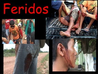 Feridos 