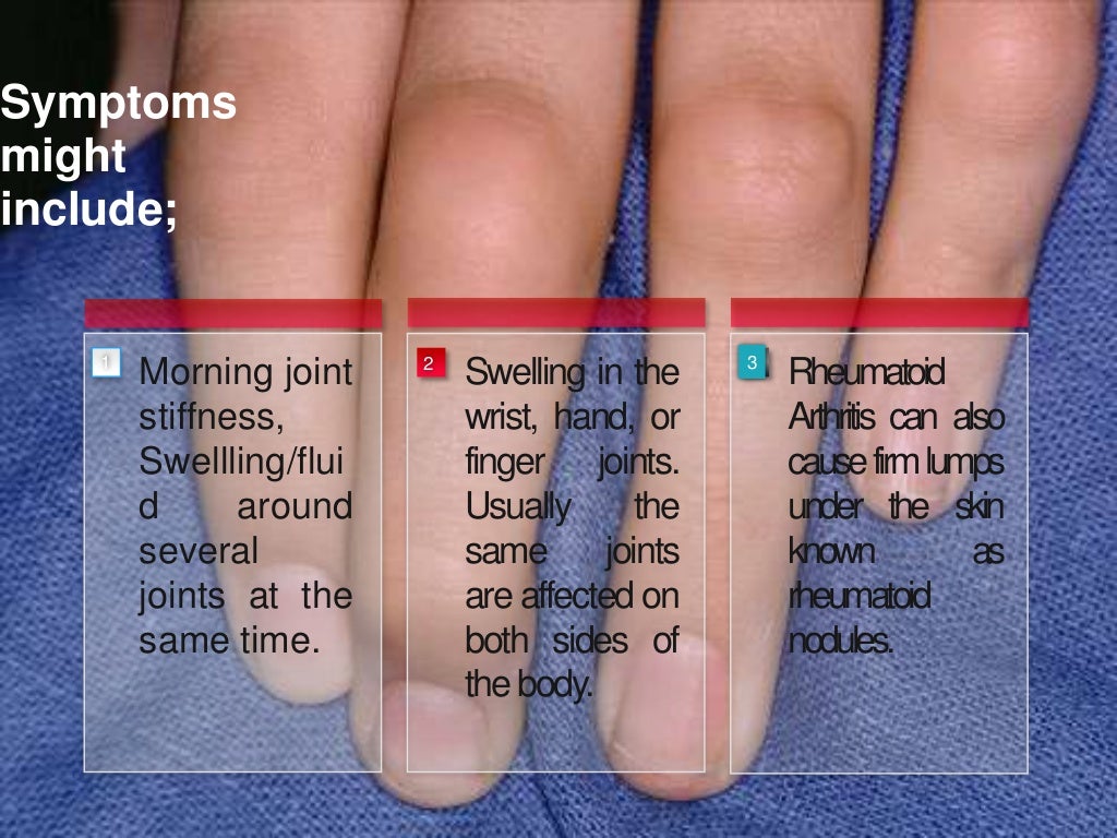 rheumatoid-arthritis-power-point