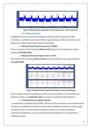 10
Figure 6:Représentation temporelle de l’enregistrement « sel117 »perturbé
I.3) Filtrage numérique
La plupart des bruits son situés à des fréquences inferieures à 2Hz et supérieure à 50Hz.
La solution à ce problème revient donc à filtrer le signal ECG par un filtre passe bande avec de
fréquence de coupure égale au deux fréquences précédente.
 Filtrage de bruit interférence secteur f=50HZ :
Nous avons utilisé un filtre numérique Butterwoorth [6] passe-bas de fréquence de coupure
normalisé fc=50/100=0.5Hz.
 Filtrage de bruit de la ligne de base f<1.5Hz :
On a utilisé un filtre numérique Butterwoorth passe-haut de fréquence de coupure normalisé
fc=2/100=0.02Hz.
Figure 7:Représentation temporelle du signal avant et après filtrage
Et pour améliorer de plus la qualité de notre ECG, nous avons abordées à la transformation en
ondelettes discrètes : [7] daubechies ‘db4’ à 8 niveaux (8=log2(Fe)) de décomposition.
 Transformation en ondelette discrète
La transformée en ondelettes discrète (DWT, Discrete Wavelet Transform) est une implémentation
utilisant un ensemble discret d'échelles et de translations d'ondelettes obéissant à certaines règles.
En d'autres termes, cette transformée décompose le signal en un ensemble d'ondelettes
mutuellement orthogonales, ce qui constitue la différence principale avec la transformée en
ondelettes continue.
 