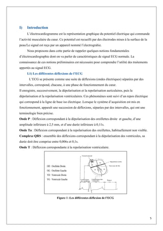 5
I) Introduction
L’électrocardiogramme est la représentation graphique du potentiel électrique qui commande
l’activité musculaire du cœur. Ce potentiel est recueilli par des électrodes mises à la surface de la
peau/Le signal est reçu par un appareil nommé l’electrograhie.
Nous proposons dans cette partie de rappeler quelques notions fondamentales
d’électrocardiographie dont on va parler de caractéristiques de signal ECG normale. La
connaissance de ces notions préliminaires est nécessaire pour comprendre l’utilité des traitements
apportés au signal ECG.
I.1) Les différentes déflexions de l’ECG
L’ECG se présente comme une suite de déflexions (ondes électriques) séparées par des
intervalles, correspond, chacune, à une phase de fonctionnement du cœur.
Il enregistre, successivement, la dépolarisation et la repolarisation auriculaires, puis la
dépolarisation et la repolarisation ventriculaires. Ces phénomènes sont suivi d’un repos électrique
qui correspond à la ligne de base iso électrique .Lorsque le système d’acquisition est mis en
fonctionnement, apparaît une succession de déflexions, séparées par des intervalles, qui ont une
terminologie bien précise.
Onde P : Déflexion correspondant à la dépolarisation des oreillettes droite et gauche, d’une
amplitude inférieure à 2,5 mm, et d’une durée inférieure à 0,11s.
Onde Ta : Déflexion correspondant à la repolarisation des oreillettes, habituellement non visible.
Complexe QRS : ensemble des déflexions correspondant à la dépolarisation des ventricules, sa
durée doit être comprise entre 0,006s et 0,1s.
Onde T : Déflexion correspondante à la repolarisation ventriculaire.
Figure 1 :Les différentes déflexion de l’ECG
 