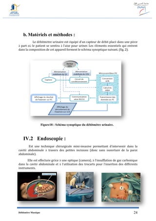 Débitmètre Massique 24
b. Matériels et méthodes :
Le débitmètre urinaire est équipé d’un capteur de débit placé dans une pièce
à part où le patient se sentira à l’aise pour uriner. Les éléments essentiels qui entrent
dans la composition de cet appareil forment le schéma synoptique suivant. (fig. 2).
Figure18 : Schéma synoptique du débitmètre urinaire.
IV.2 Endoscopie :
Est une technique chirurgicale mini-invasive permettant d’intervenir dans la
cavité abdominale à travers des petites incisions (donc sans ouverture de la paroi
abdominale).
Elle est effectuée grâce à une optique (camera), à l’insufflation de gaz carbonique
dans la cavité abdominale et à l’utilisation des trocarts pour l’insertion des différents
instruments.
 