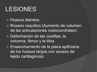 LESIONES
 Huesos blandos.
 Rosario raquítico (Aumento de volumen
  de las articulaciones costocondrales).
 Deformación de las costillas, la
  columna, fémur y la tibia.
 Ensanchamiento de la placa epificiaria
  de los huesos largos con exceso de
  tejido cartilaginoso.
 