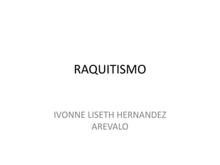 RAQUITISMO


IVONNE LISETH HERNANDEZ
        AREVALO
 
