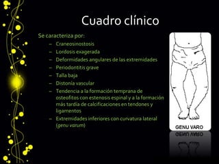 Cuadro clínico
Se caracteriza por:
– Craneosinostosis
– Lordosis exagerada
– Deformidades angulares de las extremidades
– Periodontitis grave
– Talla baja
– Distonía vascular
– Tendencia a la formación temprana de
osteofitos con estenosis espinal y a la formación
más tardía de calcificaciones en tendones y
ligamentos
– Extremidades inferiores con curvatura lateral
(genu varum)
 