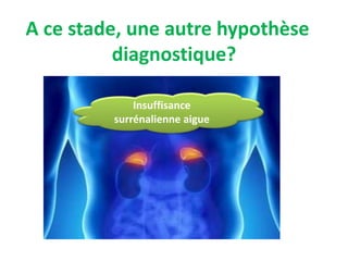 A ce stade, une autre hypothèse
diagnostique?
Insuffisance
surrénalienne aigue
 