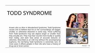 P A G E 1 4
TODD SYNDROME
Known also as Alice in Wonderland Syndrome, Todd Syndrome
causes one to believe that his or her surroundings are bigger,
smaller, or otherwise distorted in some way. Those suffering
from Todd Syndrome may see objects larger or smaller than
they actually are. They may hear sounds more loudly or quietly
than reality, and even lose sense of accurate textures or
velocities. Described as an LSD trip without the accompanying
euphoria, the terrifying Todd Syndrome is extremely rare. In
most cases it affects people in their 20s who have a history of
drug use or brain cancer.
 