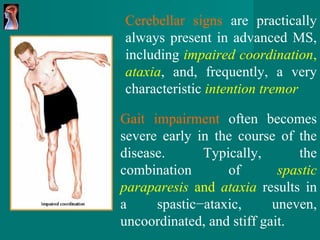 Cerebellar signs  are practically always present in advanced   MS, incl u ding   impaired   coordination ,   ataxia , and,   frequently, a very characteristic  intention tremor Gait impairment  often becomes severe early in the   course of the disease. Typically, the   combination of   spastic   paraparesis  and  ataxia  results in a spastic−ataxic,   uneven,   uncoordinated, and stiff gait . 