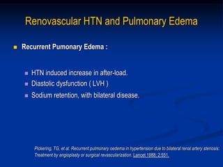Renovascular HTN and Pulmonary Edema
 Recurrent Pumonary Edema :
 HTN induced increase in after-load.
 Diastolic dysfunction ( LVH )
 Sodium retention, with bilateral disease.
Pickering, TG, et al. Recurrent pulmonary oedema in hypertension due to bilateral renal artery stenosis:
Treatment by angioplasty or surgical revascularization. Lancet 1988; 2:551.
 