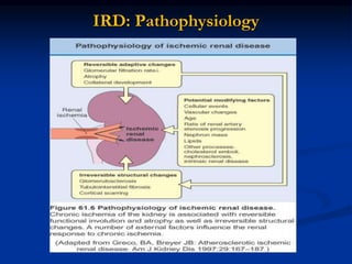 IRD: Pathophysiology
 