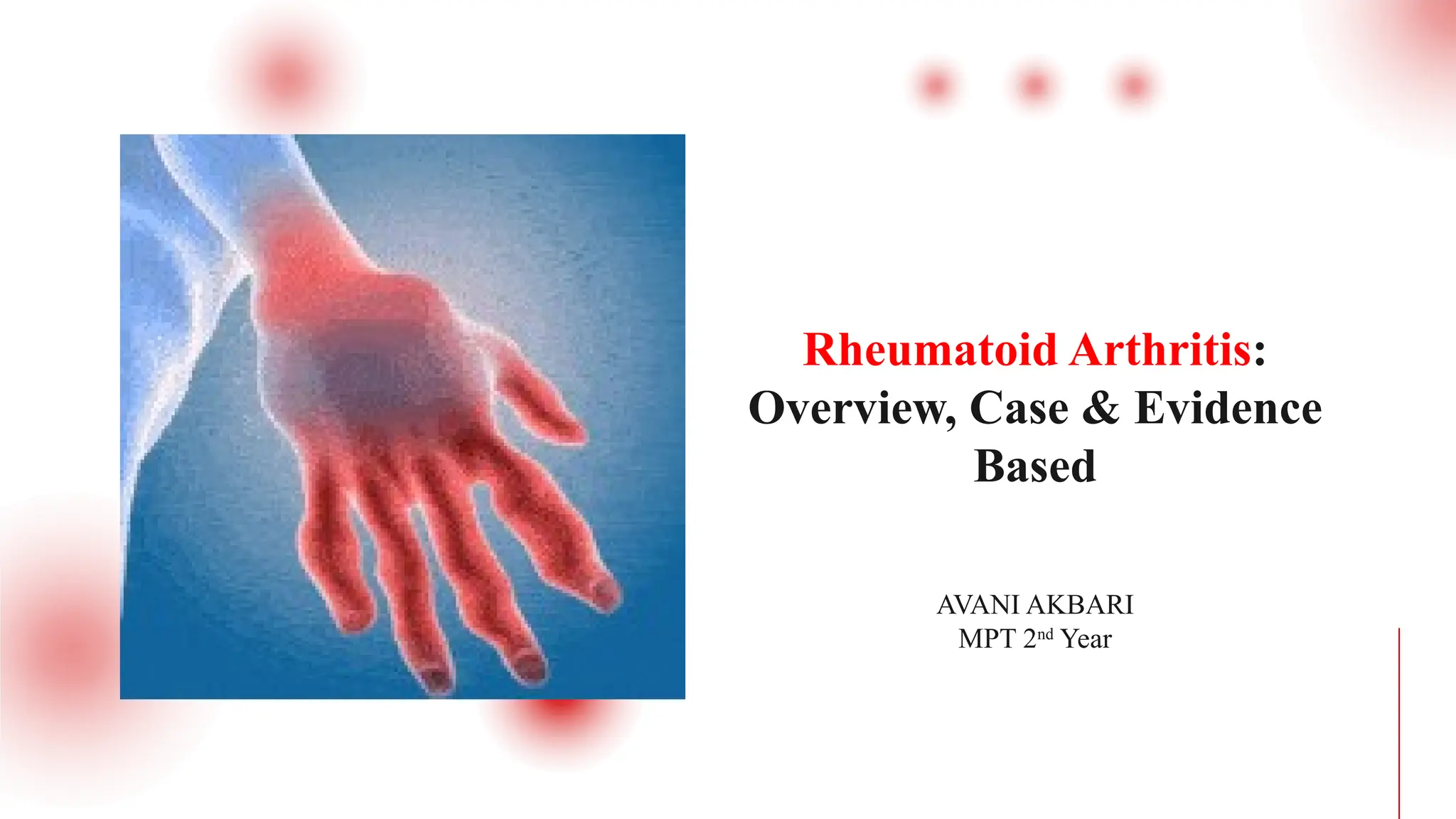 Rheumatoid Arthritis: A Comprehensive Physiotherapy Perspective – Case ...