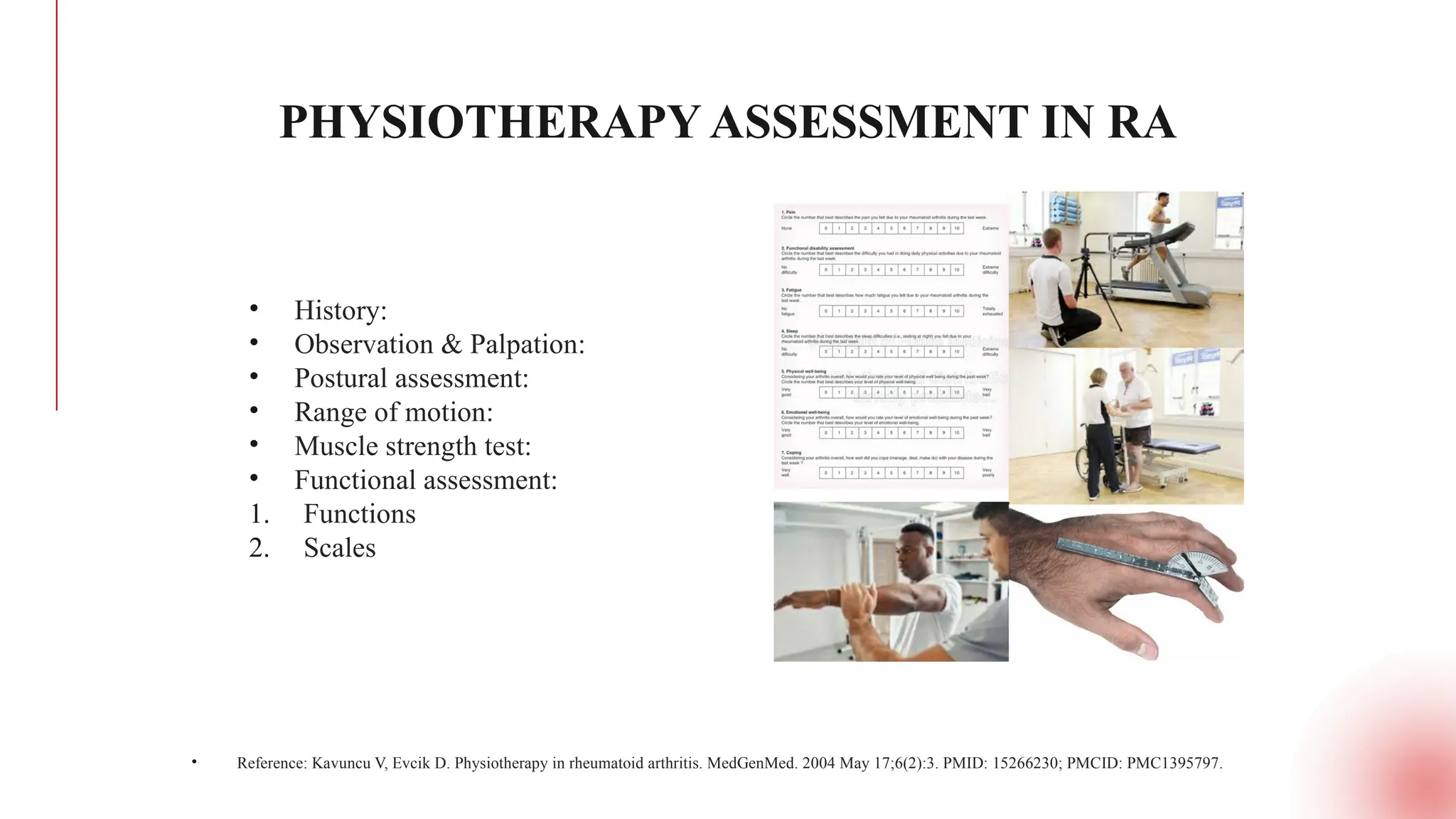 Rheumatoid Arthritis: A Comprehensive Physiotherapy Perspective – Case ...