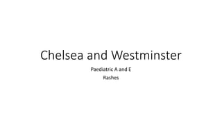 Chelsea and Westminster
Paediatric A and E
Rashes
 