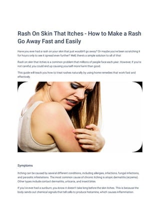 Rash On Skin That Itches - How to Make a Rash
Go Away Fast and Easily
Have you ever had a rash on your skin that just wouldn't go away? Or maybe you've been scratching it
for hours only to see it spread even further? Well, there's a simple solution to all of this!
Rash on skin that itches is a common problem that millions of people face each year. However, if you're
not careful, you could end up causing yourself more harm than good.
This guide will teach you how to treat rashes naturally by using home remedies that work fast and
effectively.


Symptoms
Itching can be caused by several different conditions, including allergies, infections, fungal infections,
and parasitic infestations. The most common cause of chronic itching is atopic dermatitis (eczema).
Other types include contact dermatitis, urticaria, and insect bites.
If you’ve ever had a sunburn, you know it doesn’t take long before the skin itches. This is because the
body sends out chemical signals that tell cells to produce histamine, which causes inflammation.
 