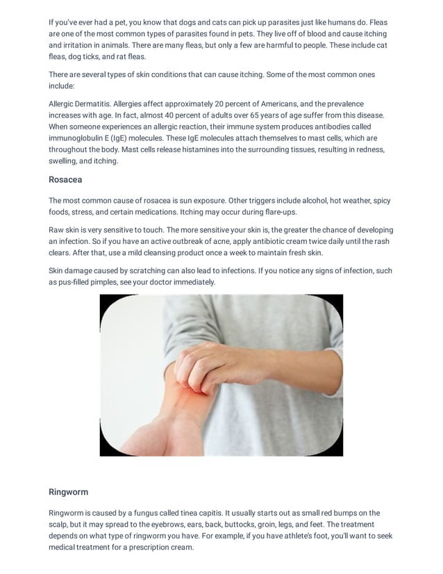 Rash On Skin That Itches How to Make a Rash Go Away Fast and Easily