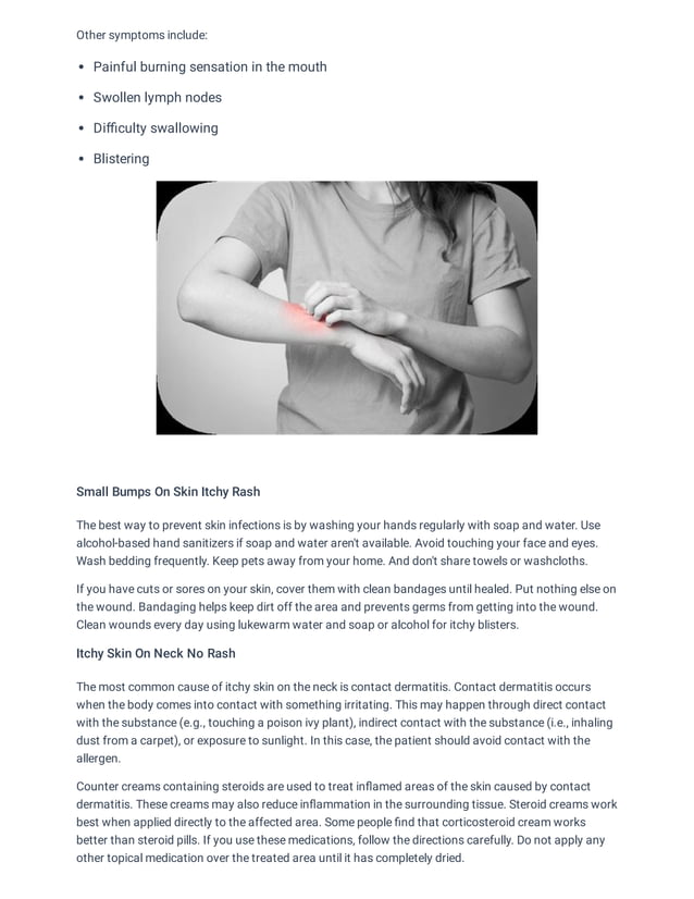 Rash On Skin That Itches How to Make a Rash Go Away Fast and Easily