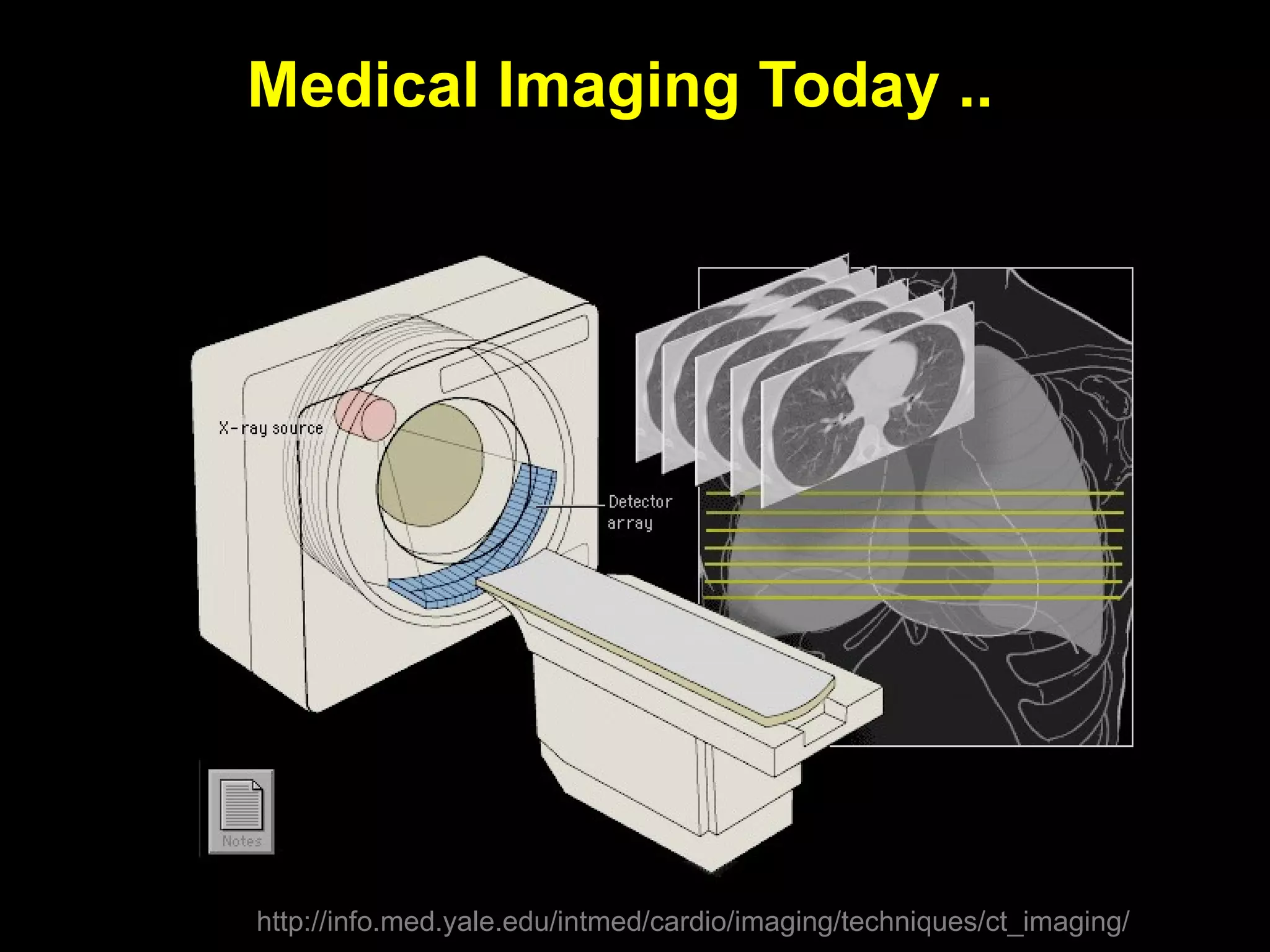 Medical Imaging Today ..  http://info.med.yale.edu/intmed/cardio/imaging/techniques/ct_imaging/ 