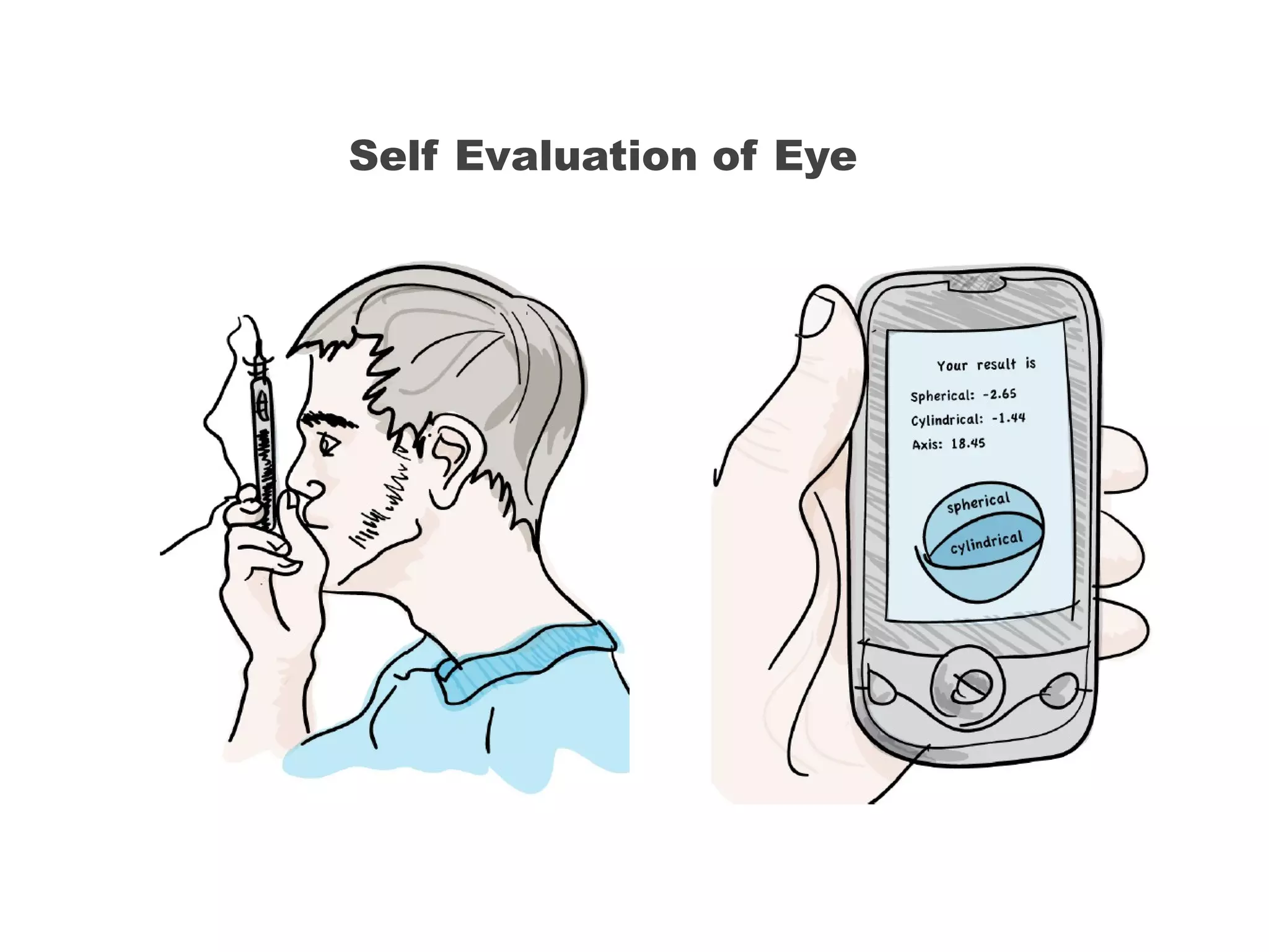 Self Evaluation of Eye 