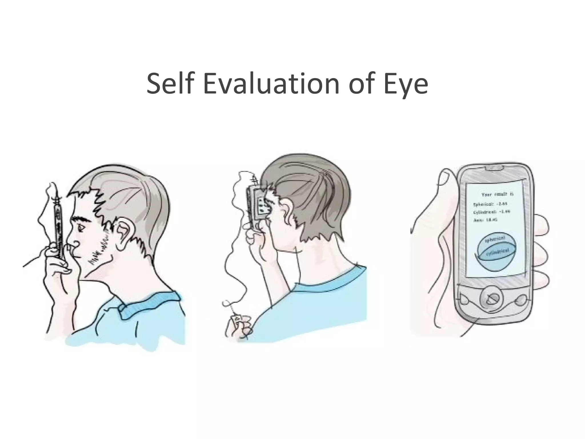 Self Evaluation of Eye 
