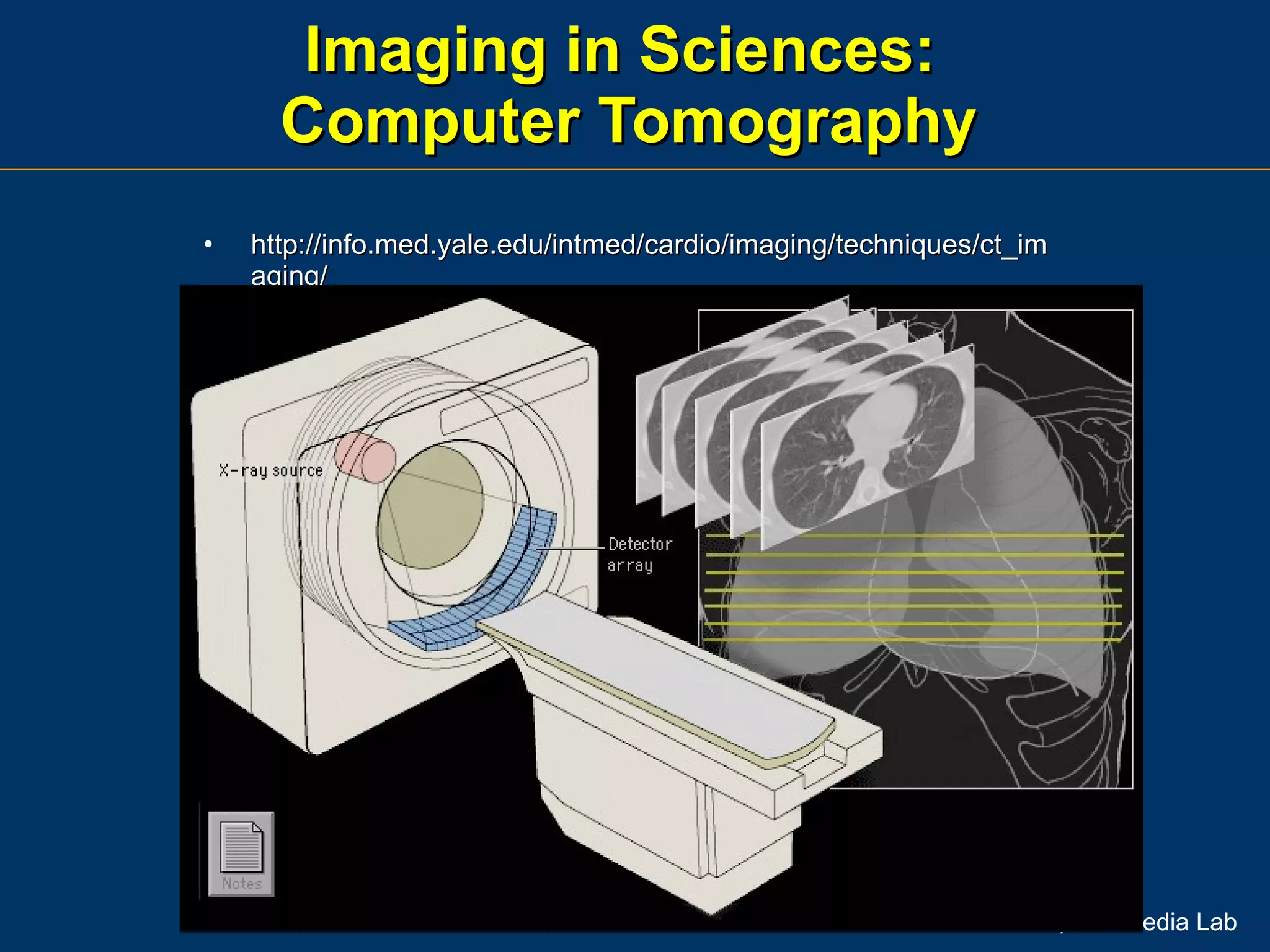 Imaging in Sciences:  Computer Tomography http://info.med.yale.edu/intmed/cardio/imaging/techniques/ct_imaging/ 