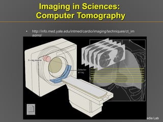 Imaging in Sciences:  Computer Tomography http://info.med.yale.edu/intmed/cardio/imaging/techniques/ct_imaging/ 