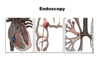 Endoscopy 