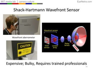 Shack-Hartmann Wavefront Sensor Expensive; Bulky, Requires trained professionals Wavefront aberrometer 