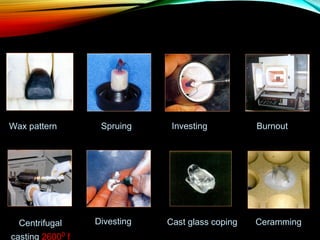 Wax pattern

Centrifugal
casting 26000 f

Spruing

Divesting

Investing

Cast glass coping

Burnout

Ceramming

 
