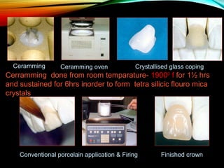 Ceramming

Ceramming oven

Crystallised glass coping

Cerramming done from room temparature- 19000 f for 1½ hrs
and sustained for 6hrs inorder to form tetra silicic flouro mica
crystals

Conventional porcelain application & Firing

Finished crown

 