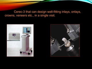 Cerec-3 that can design well-fitting inlays, onlays,
crowns, veneers etc., in a single visit.

 
