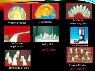 Working model

In-Ceram
application

Shrinkage of dies

Duplication

Al2O3 slip

In-Ceram
refractory dies

vita inceramat

120 0C- 2hrs

Glass infiltration
4hrs 11000C

 