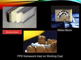 Zirconia block

Milled Block

FPD framework tried on Working Cast

 