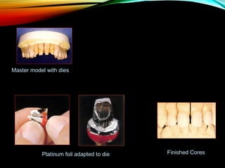 Master model with dies

Platinum foil adapted to die

Finished Cores

 