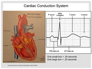Rasltin-ECGs_The_Basics_and.pptx