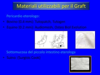 Materiali utilizzabili per il Graft
  Pericardio eterologo:
• Bovino (0.4 mm): Tutopatch, Tutogen
• Equino (0.2 mm): Audiomesh, Osteo Biol Evolution




  Sottomucosa del piccolo intestino eterologa
• Suino: (Surgisis Cook)
 