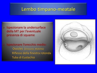 Lembo timpano-meatale


   Ispezionare la undersurface
    della MT per l’eventuale
    presenza di squame

   Ispezionare l’orecchio medio:
        Ossicles (Erosione, Mobilità)
        Riflesso della finestra rotonda
        Tuba di Eustachio
 