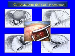 Calibrazione del CUE (se necessario)


      (*)
 