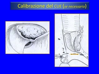 Calibrazione del CUE (se necessario)
 