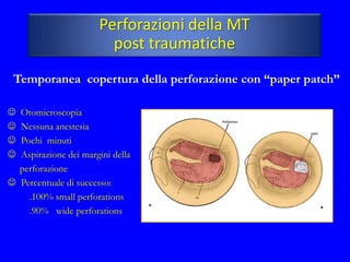 Perforazioni della MT
                         post traumatiche
 Temporanea copertura della perforazione con “paper patch”

 Otomicroscopia
 Nessuna anestesia
 Pochi minuti
 Aspirazione dei margini della
  perforazione
 Percentuale di successo:
    .100% small perforations
    .90% wide perforations
 