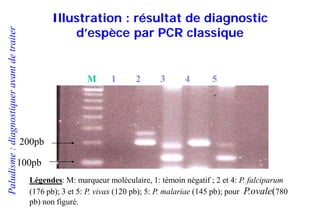 Paludisme:diagnostiqueravantdetraiter
Illustration : résultat de diagnostic
d’espèce par PCR classique
M 1 2 3 4 5
100pb
200pb
Légendes: M: marqueur moléculaire, 1: témoin négatif ; 2 et 4: P. falciparum
(176 pb); 3 et 5: P. vivax (120 pb); 5: P. malariae (145 pb); pour P.ovale(780
pb) non figuré.
 