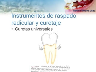 Natalia Medina Lazo

Instrumentos de raspado
radicular y curetaje
• Curetas universales
 